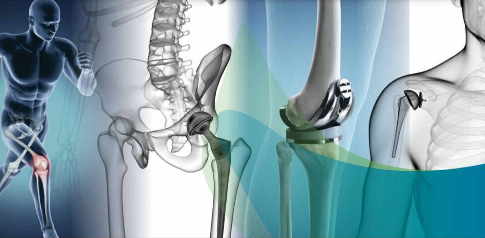 Joint Replacement department at DHS Hospital Ahmedabad