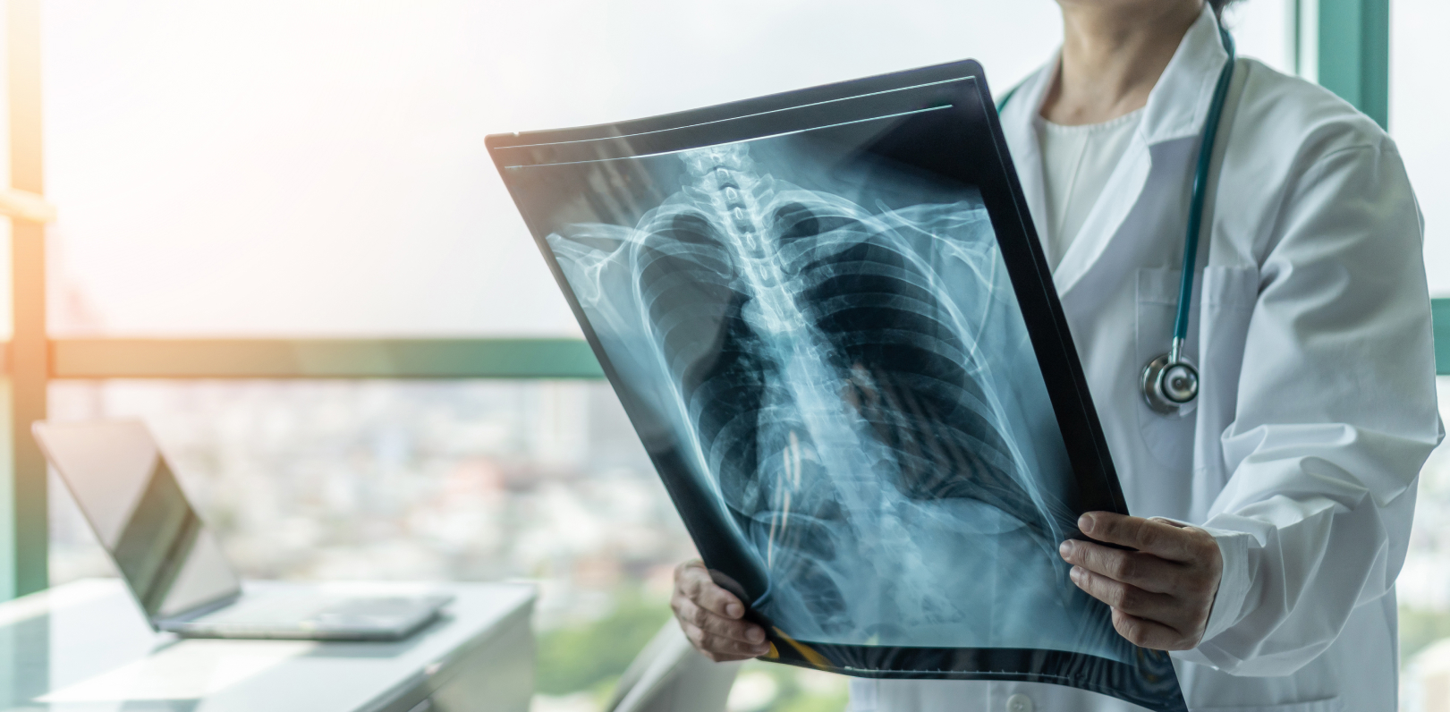 Pulmonology department at DHS Hospital Ahmedabad