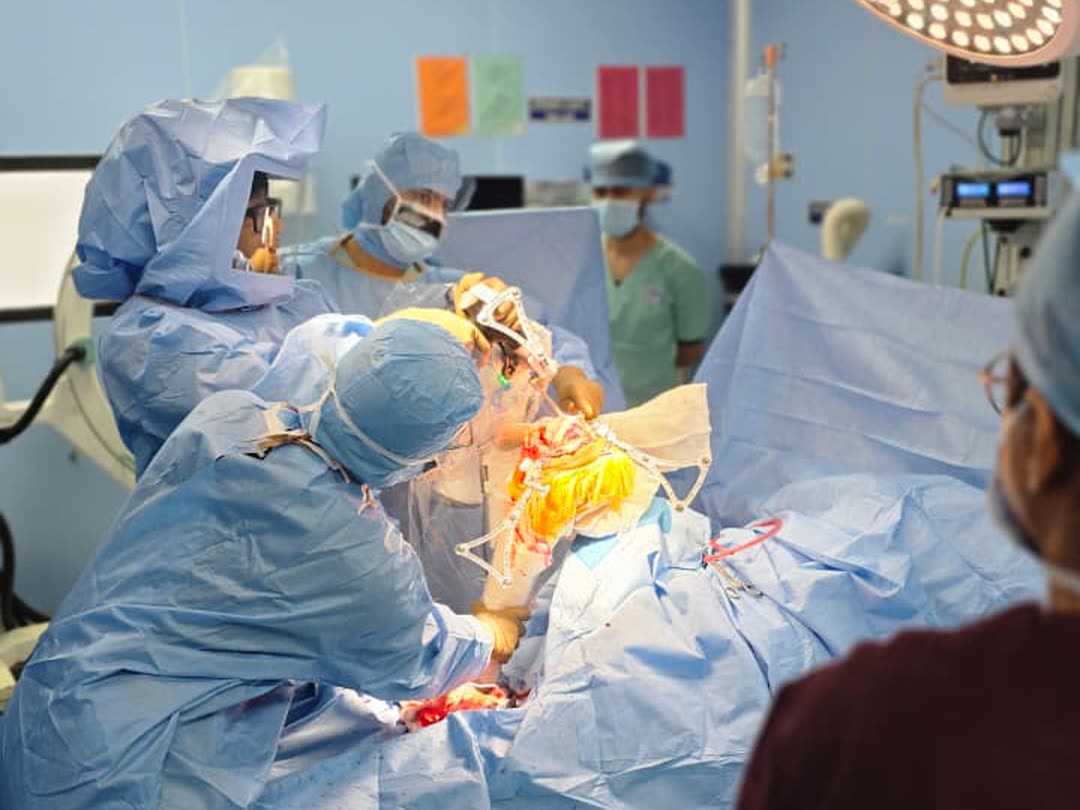 VELYS robotic knee replacement under way in the DHS Multispecialty Hospital operation theatre — surgeon using the VELYS tracking array, with assisting team and surgical lights overhead